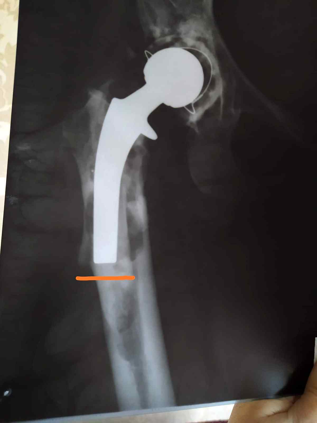 dopomoga-vinnitsia-3 2