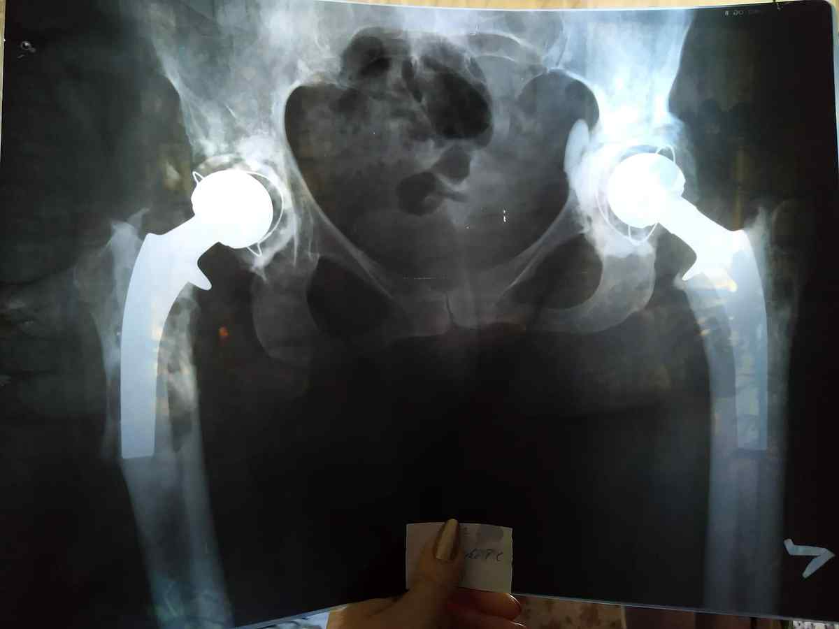 dopomoga-vinnitsia-4 1