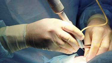 безкоштовні операції для бійців фото