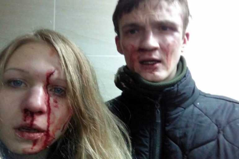 побили Віту Заверуху фото