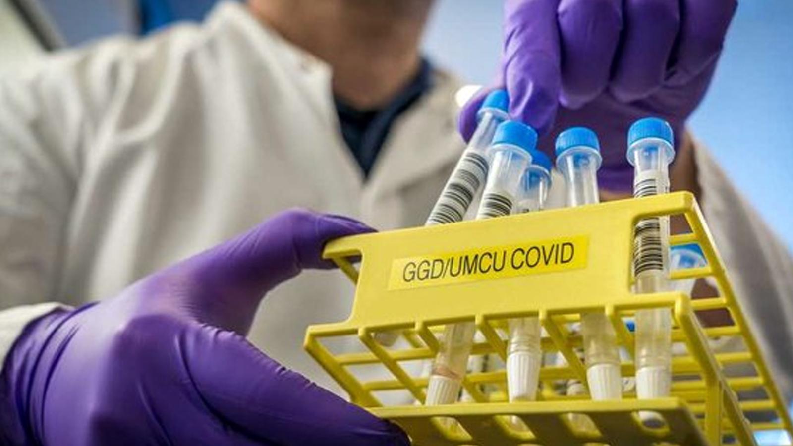 Минулої доби на Вінниччині зафіксовано 161 нових випадків COVID-19