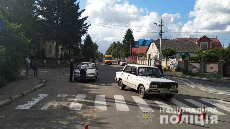 Внаслідок ДТП на Вінниччині пенсіонерку госпіталізували з переломом стегна