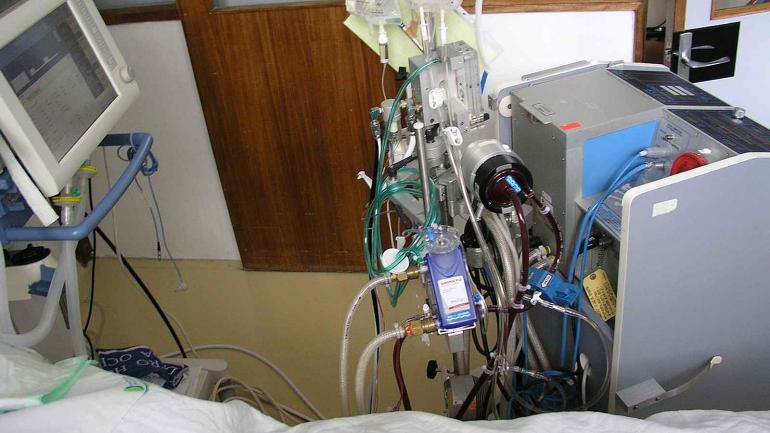 Вінницькій області потрібен апарат для порятунку від ускладнень коронавірусу
