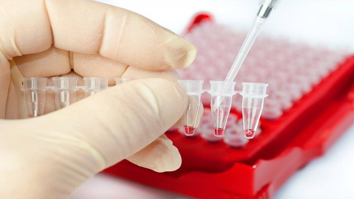 У Вінниці безкоштовно перевірятимуть на ВІЛ та гепатит