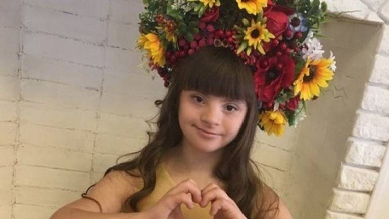 Вінничанка із синдромом Дауна зайняла перше місце в конкурсі краси