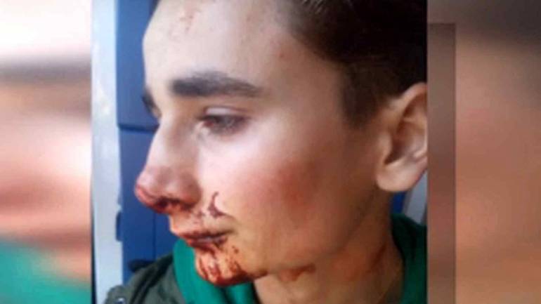 За побиття хлопчика з Іллінців сусідів можуть лише оштрафувати на 800 гривень